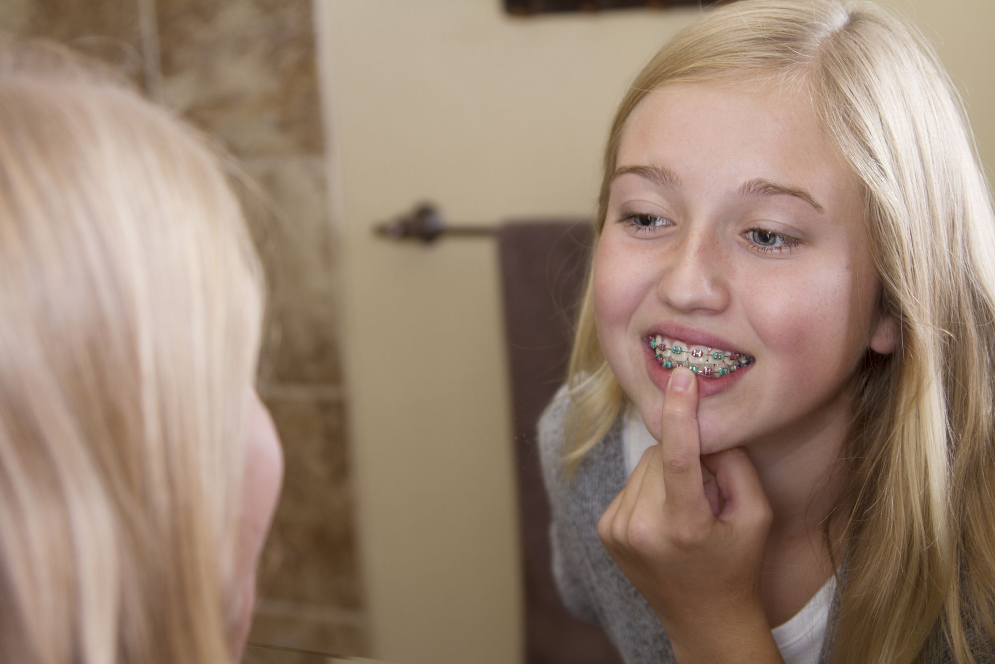 clear aligners wesley chapel