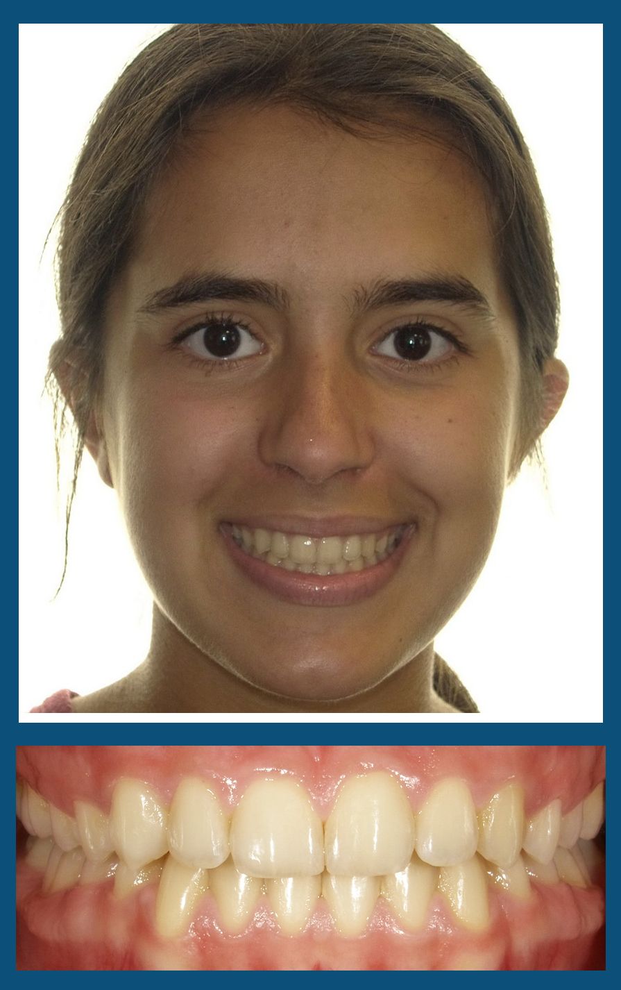 orthodontist charlotte nc