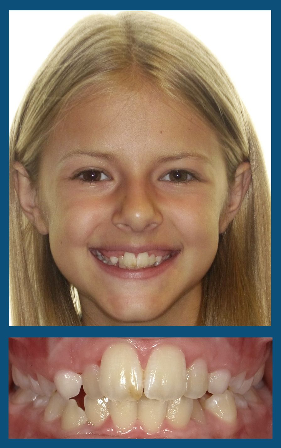 orthodontist charlotte nc