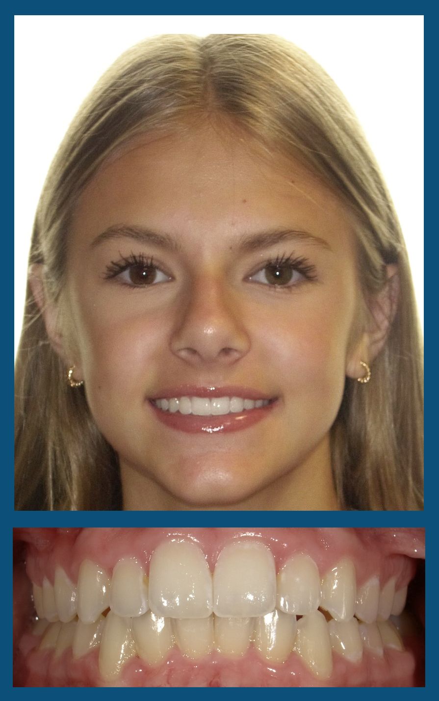 orthodontist charlotte nc
