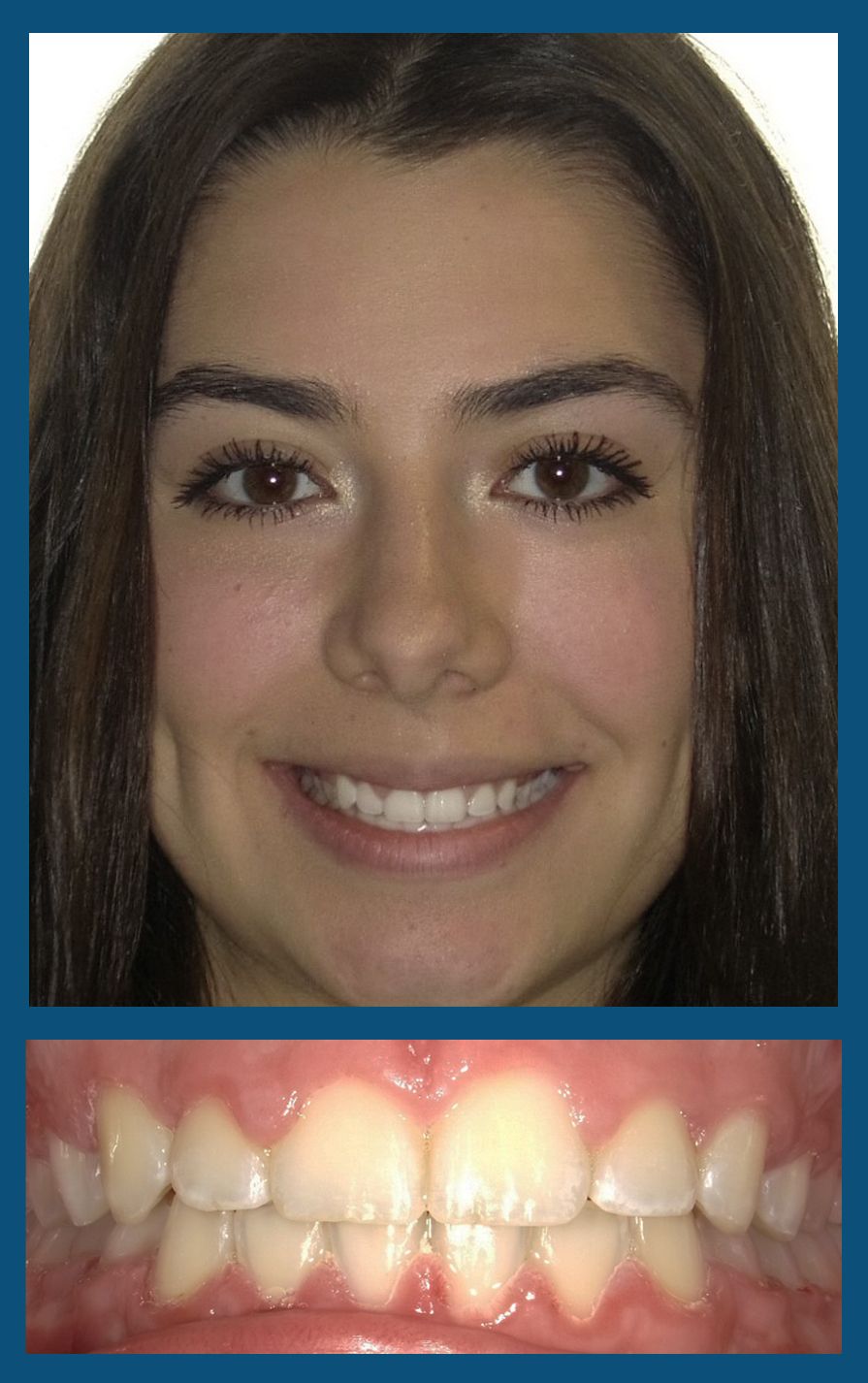 orthodontist charlotte nc