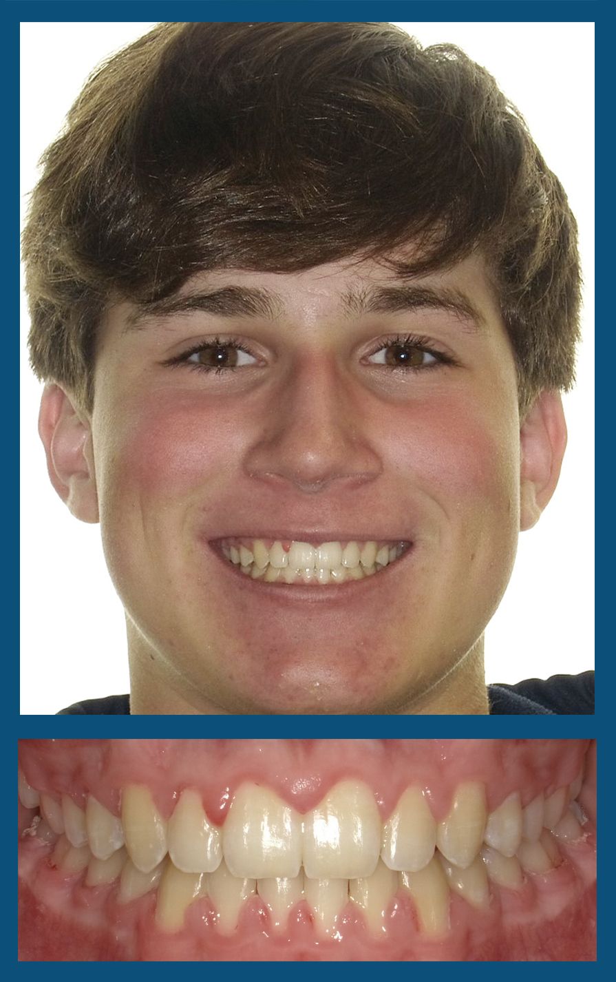 orthodontist charlotte nc