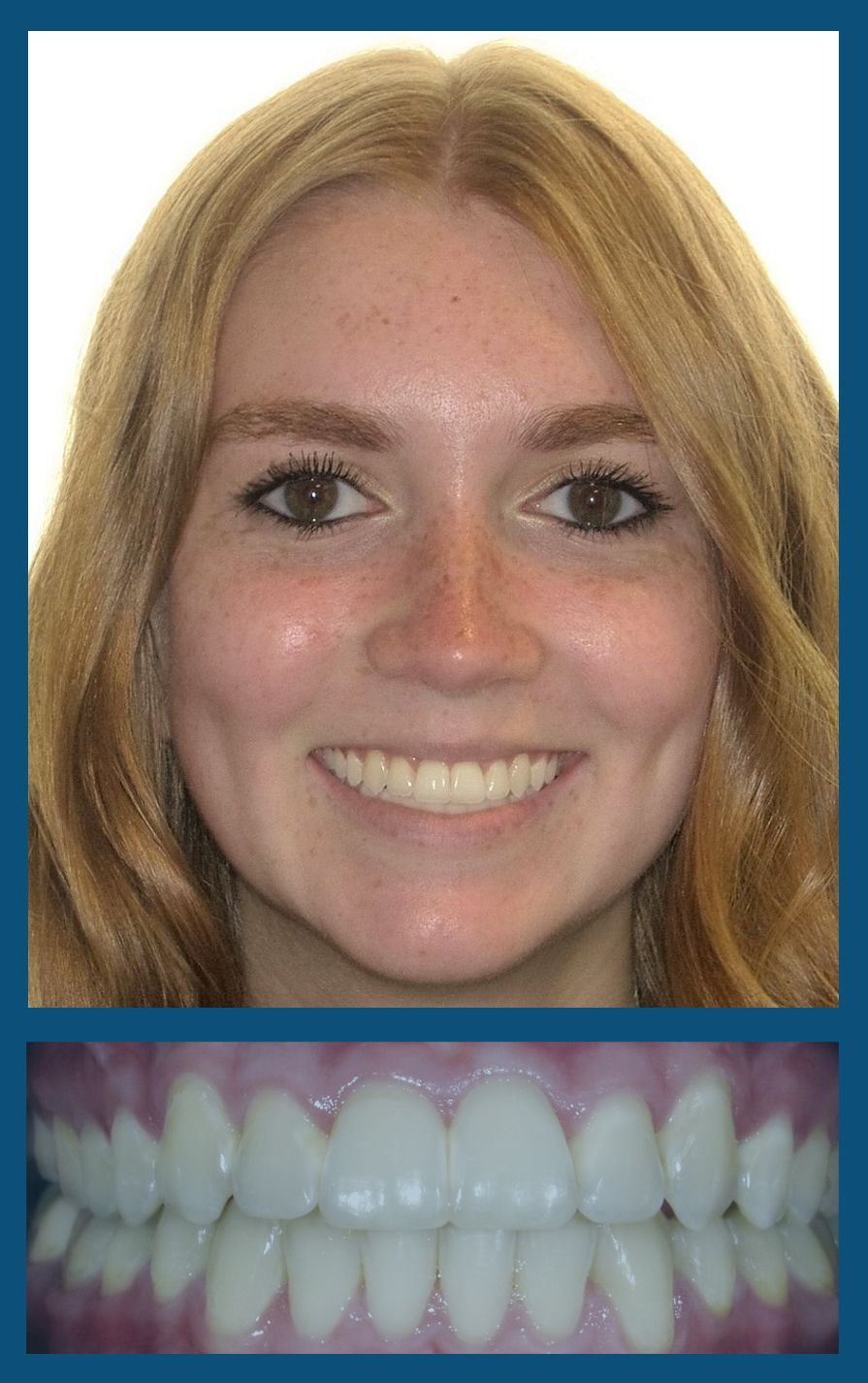 orthodontist charlotte nc