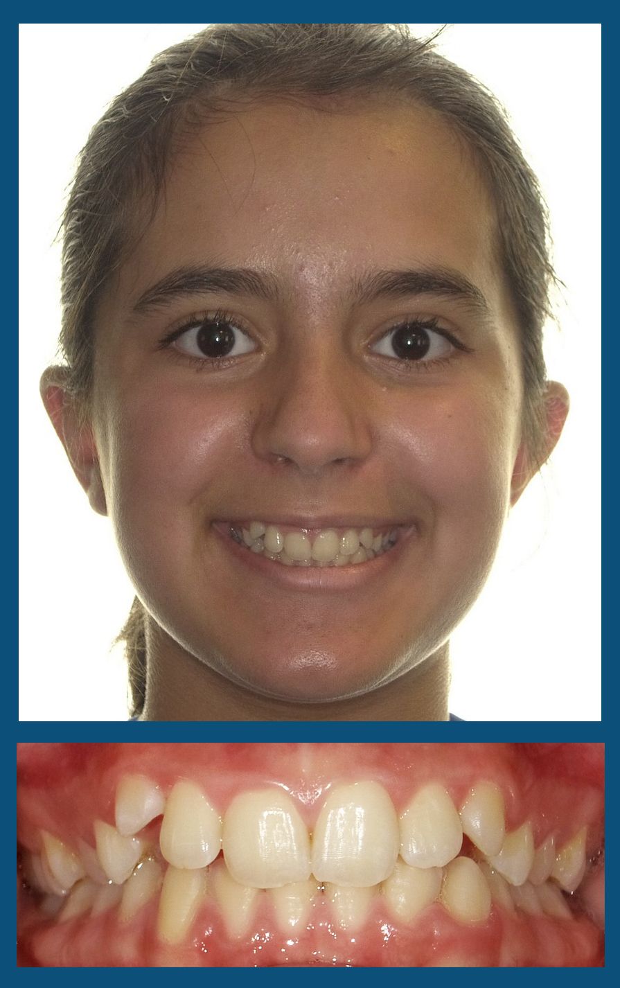 orthodontist charlotte nc