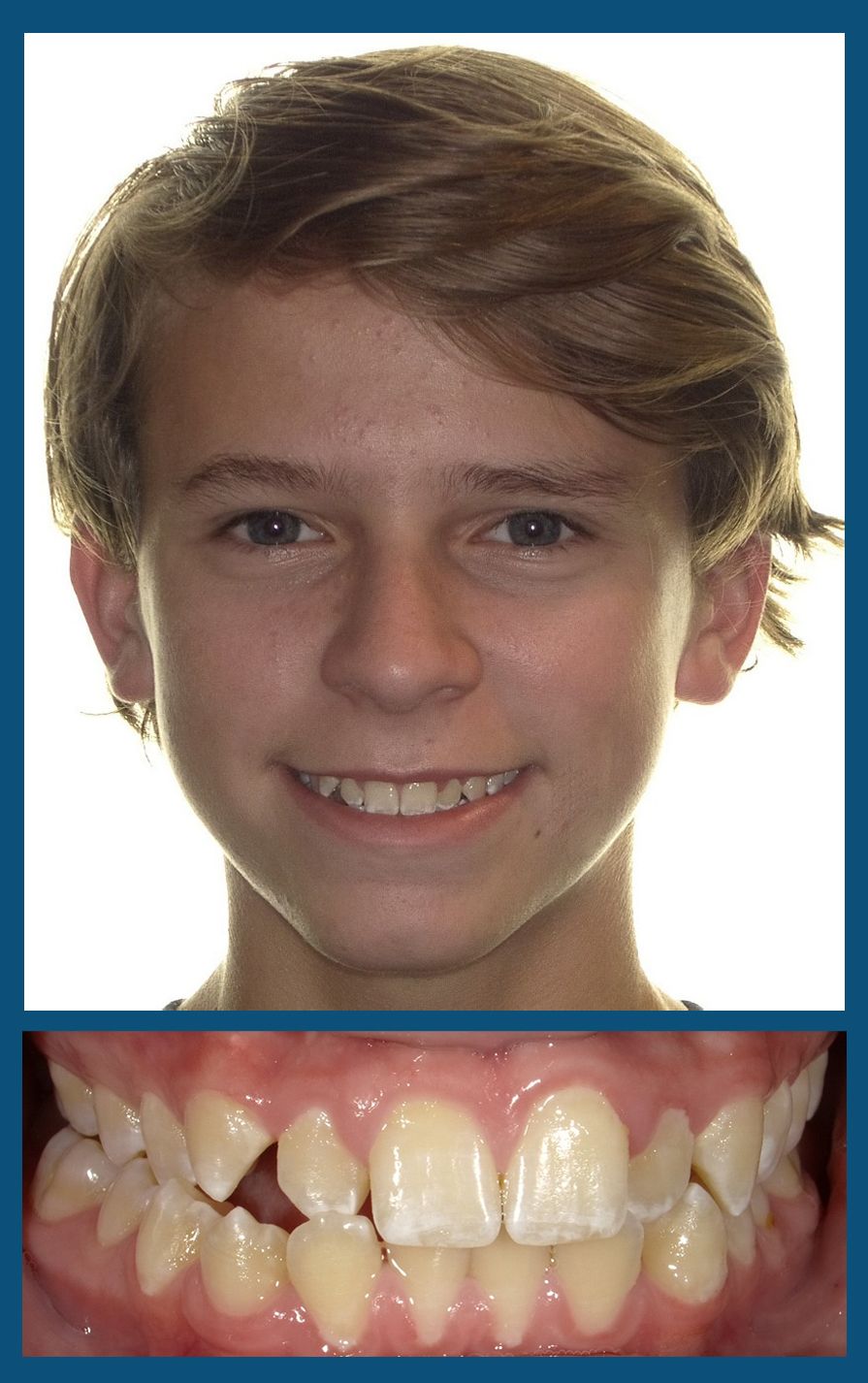 orthodontist charlotte nc