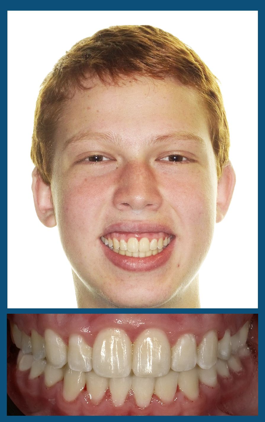 orthodontist charlotte nc