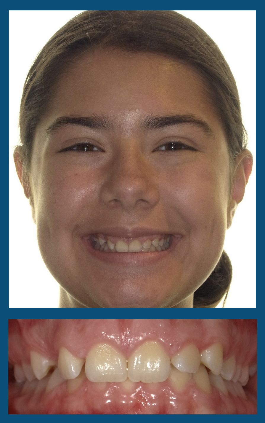 orthodontist charlotte nc