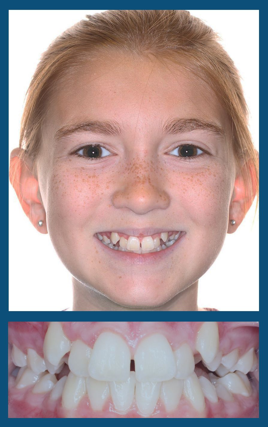 orthodontist charlotte nc