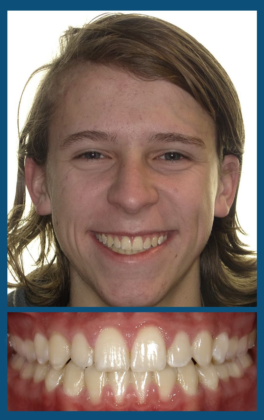 orthodontist charlotte nc