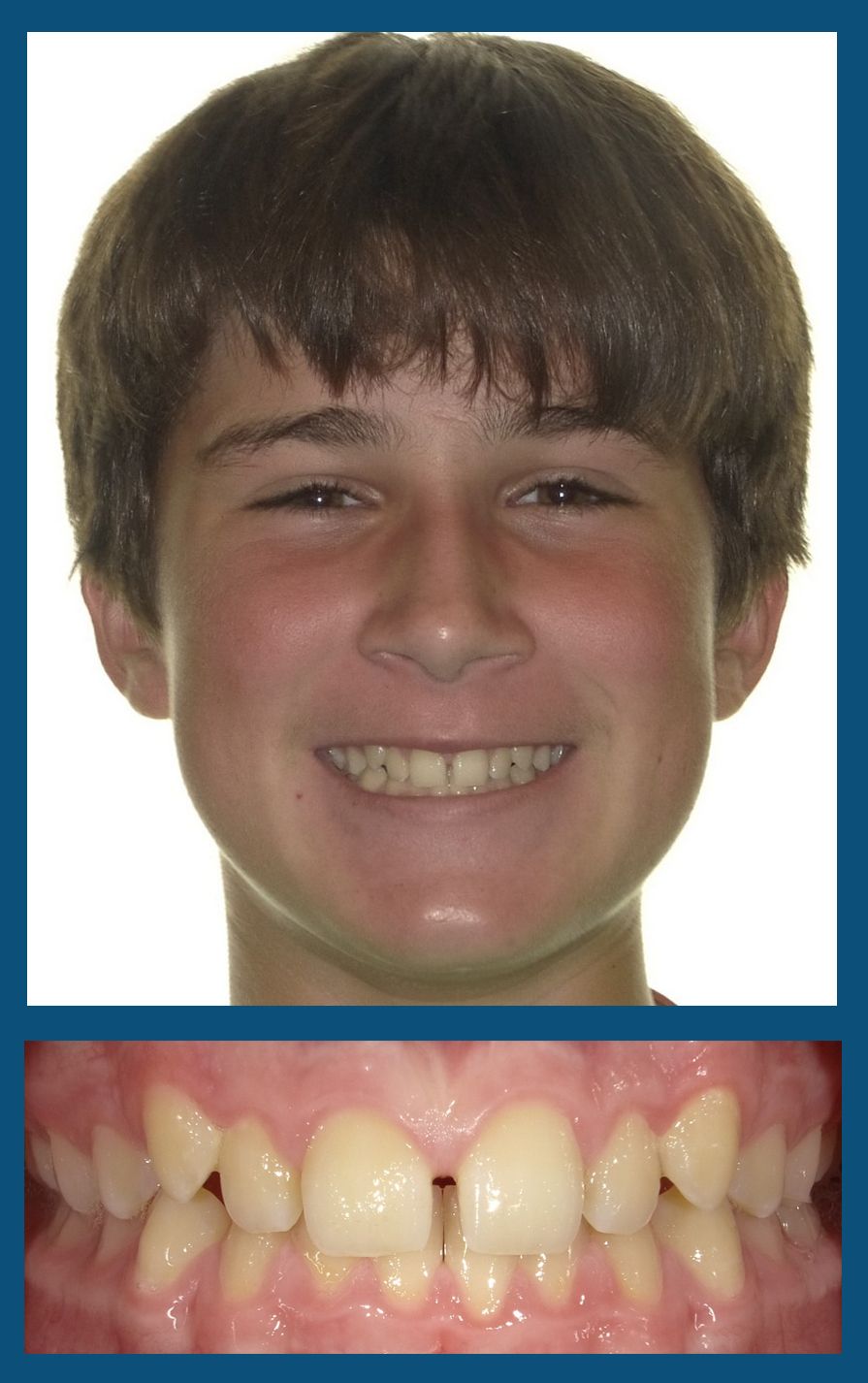 orthodontist charlotte nc